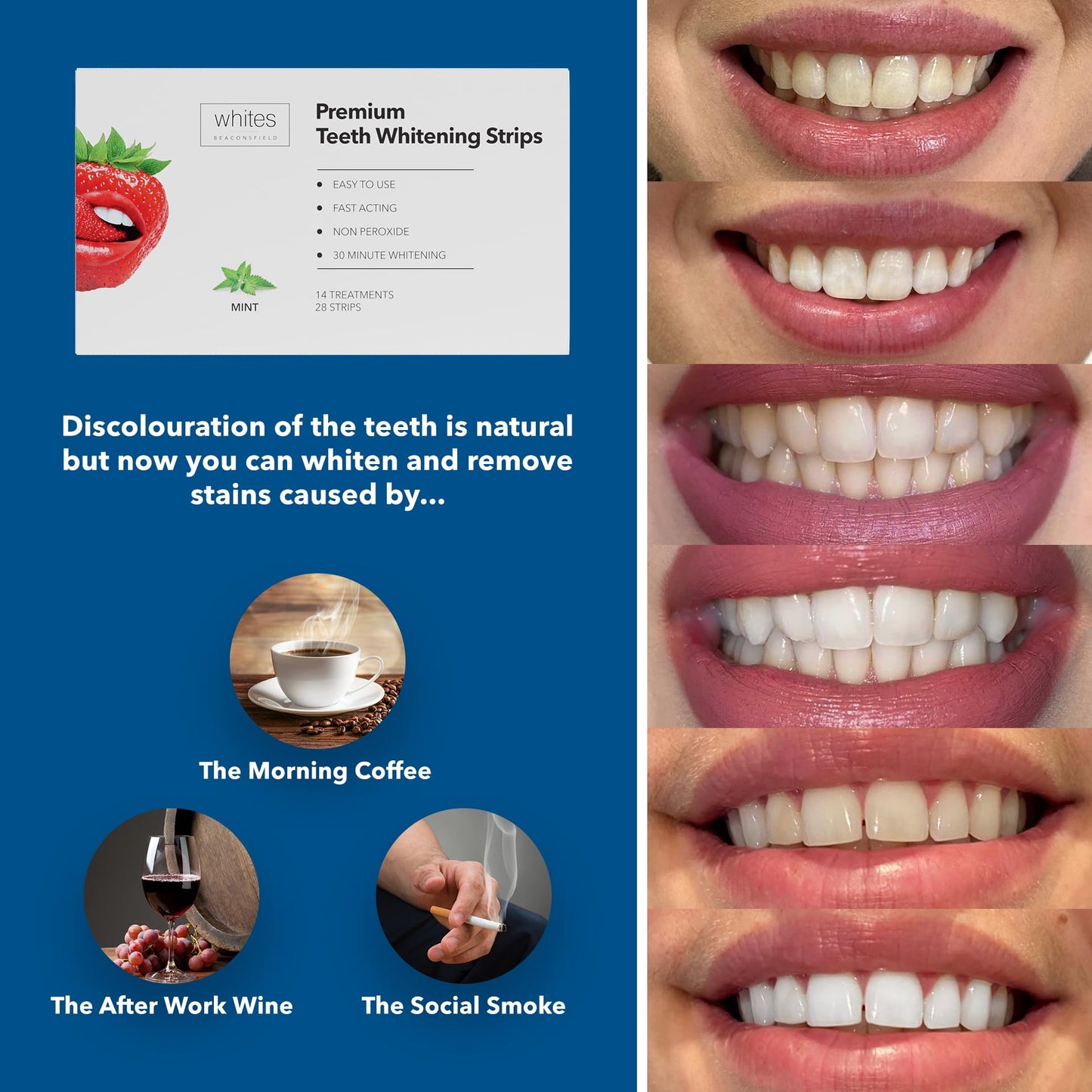 Whites Beaconsfield Teeth Whitening Strips, 28 Strips (14-Day Treatment) – Non-Peroxide Formula, Enamel-Safe, Brighten Teeth Fast, Removes Coffee, Wine, Smoke Stains, Safe for Sensitive Teeth