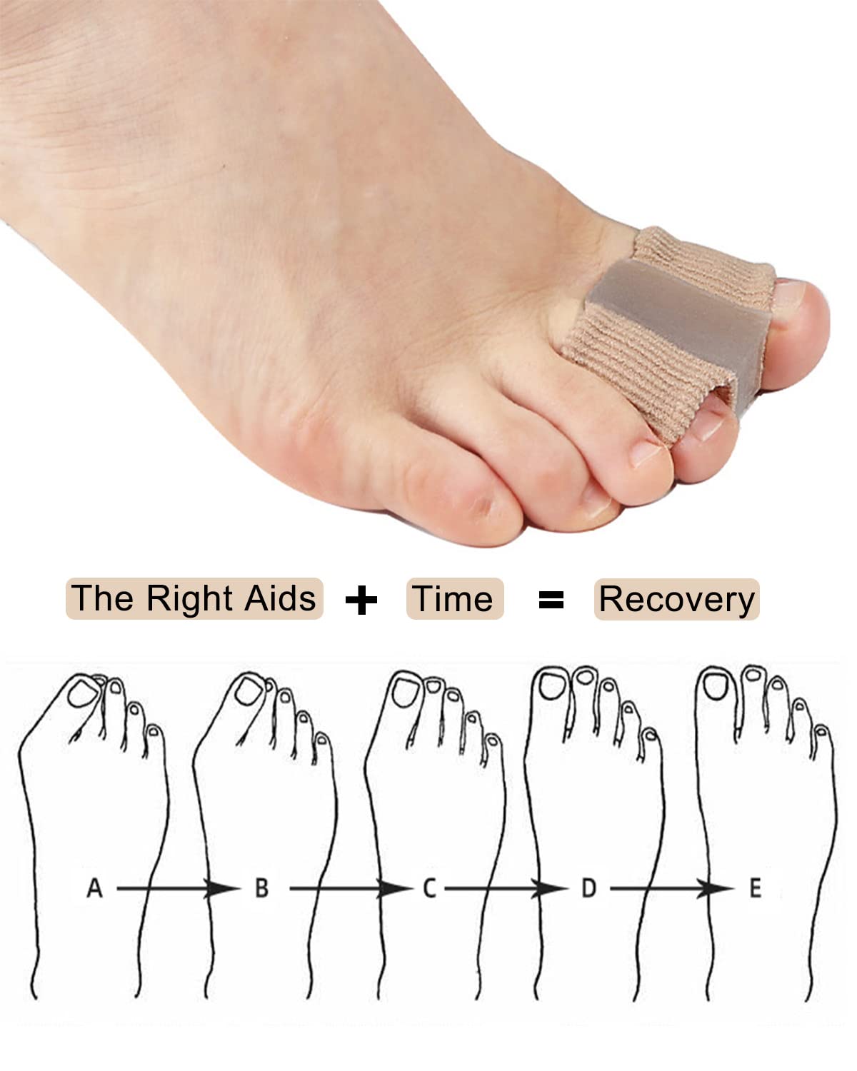 Golbylicc Bunion Toe Separators for Overlapping Toes Women Men, Gel Toe Spacers Bunion Corrector with 2 Loops for feet, Hammer Toe Straightener (2PC)
