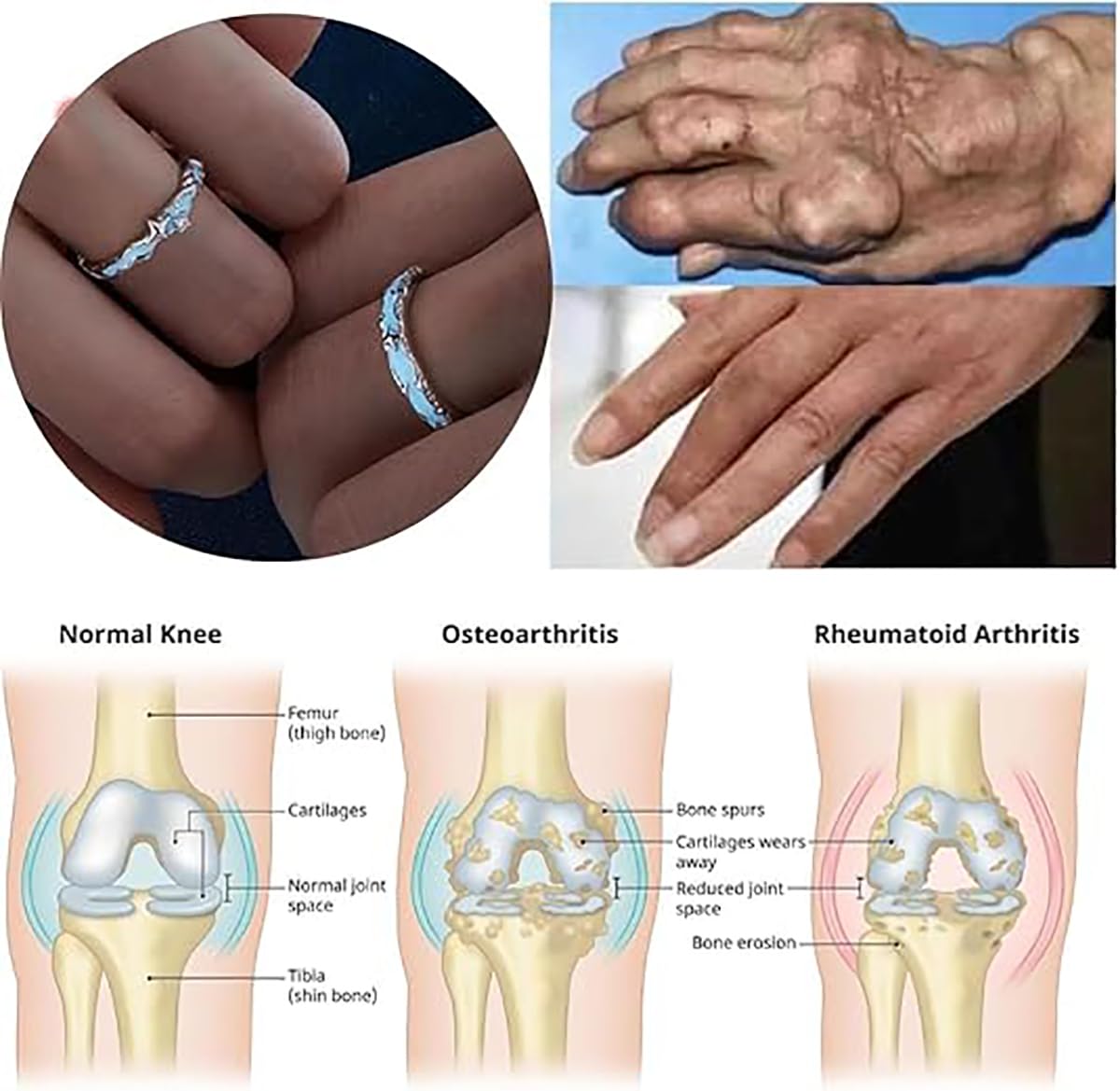 IMMUNOTRAX Magnetic Therapy Luminous Titanium Ion Adjustable Ring - Lymphatic Magtherapy Luminous Jewelry for Couples,Glow-in-Dark Wellness Ring Gift for Men/Women (B For Women)