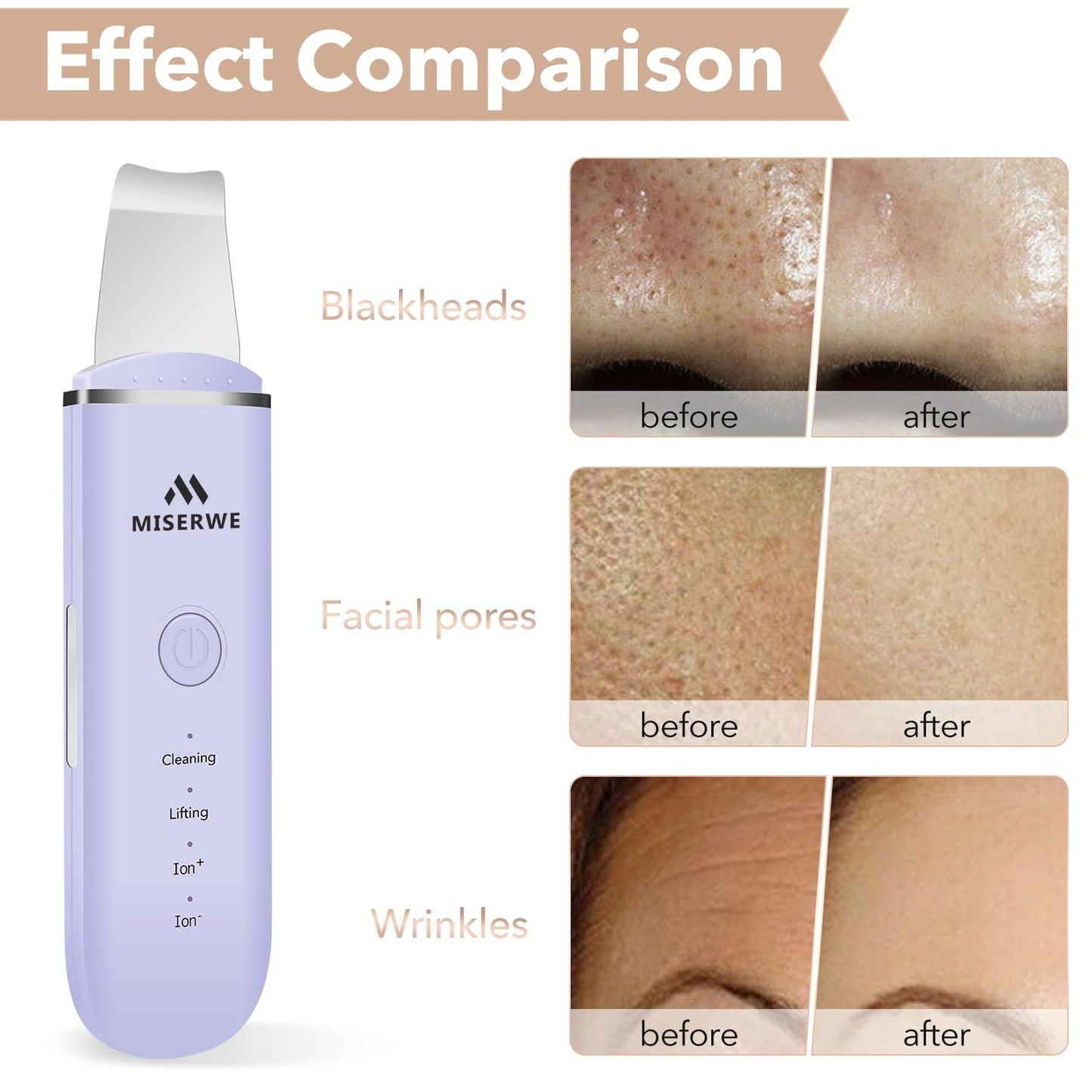 Skin Scrubber Face Skin Spatula Facial Scrubber Spatula for Deep Cleansing Blackhead Remover Pore Cleaner with 4 Modes (White)