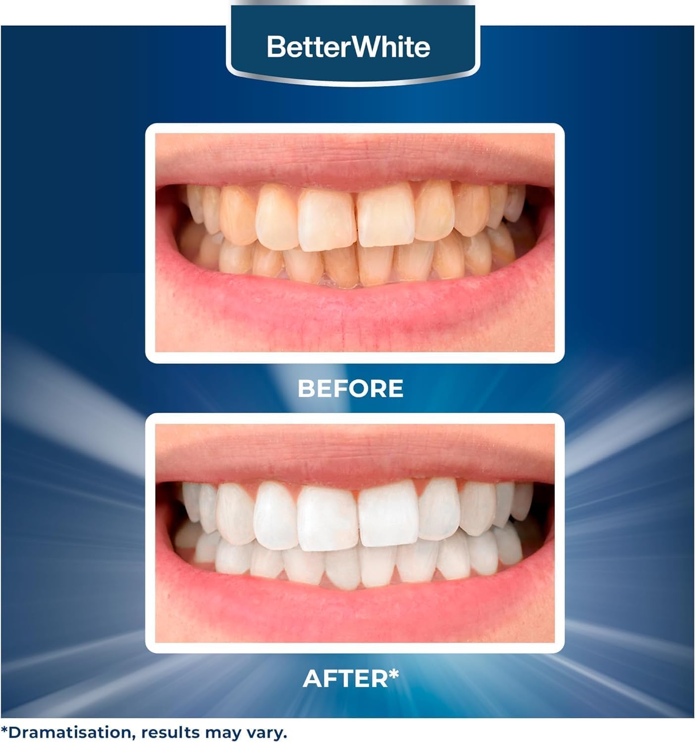 BetterWhite Professional Teeth Whitening Strips 7 Treatments - Enamel Safe - Non-Sensitive Formula - 14 Peroxide-Free Whitening Strips - Dentist Formulated Teeth Whitening Kit