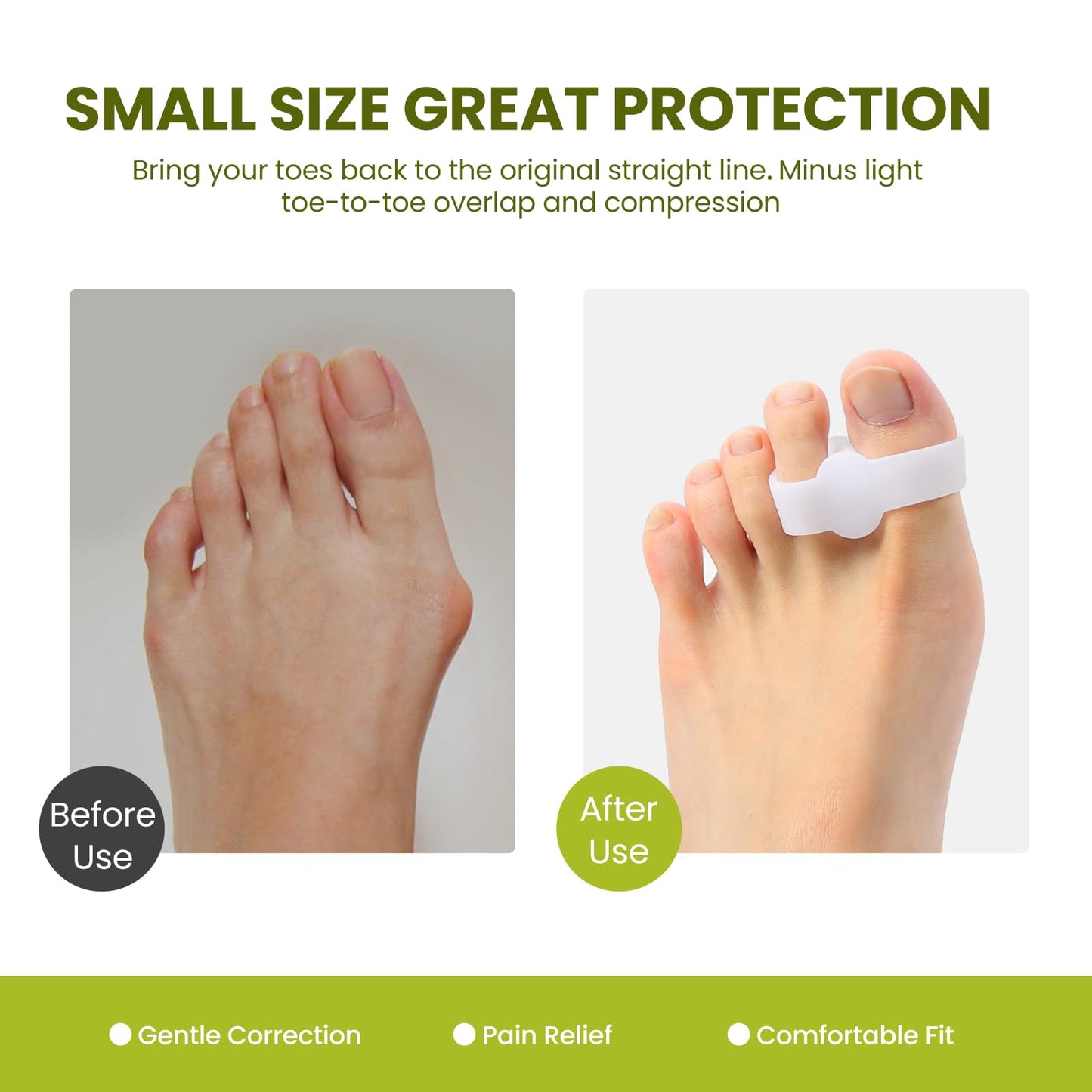 Bukihome Toe Separators Bunion Corrector - 8 Pack Big Toe Spacers with 2 Loops, Suitable for Bunion and Overlapping Toes, Reduce Foot Pain(White)
