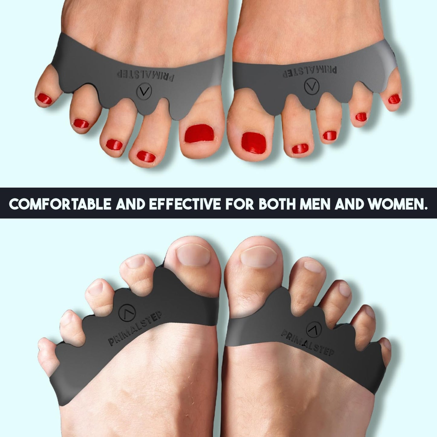 PrimalStep Toe Separators, Spreaders, Spacers, Straightener to Correct Toes for Men and Women, Bunion Corrector, Foot Pain, Plantar Fasciitis, Over 50% Thicker, XL