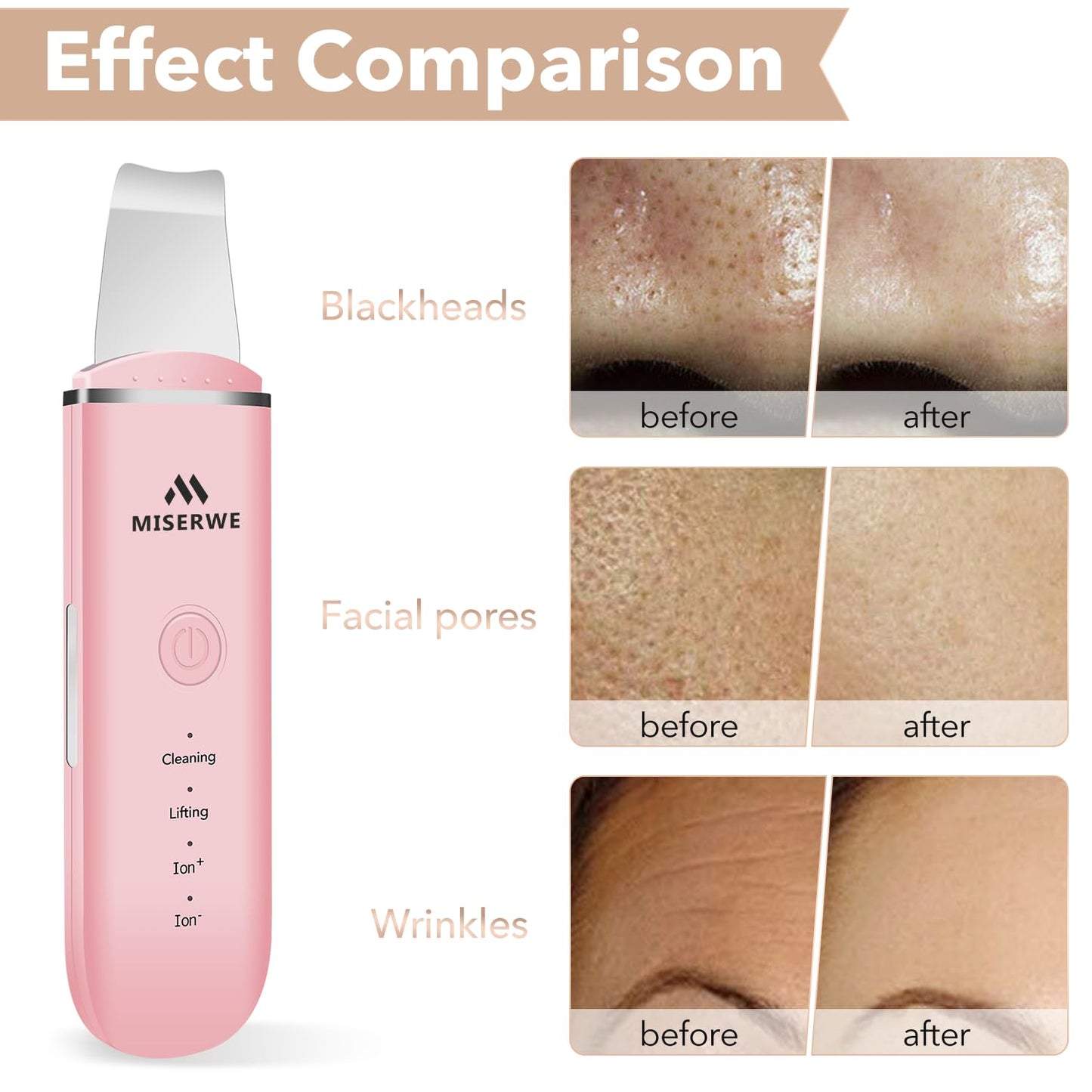 Skin Scrubber Face Skin Spatula Facial Scrubber Spatula for Deep Cleansing Blackhead Remover Pore Cleaner with 4 Modes (White)