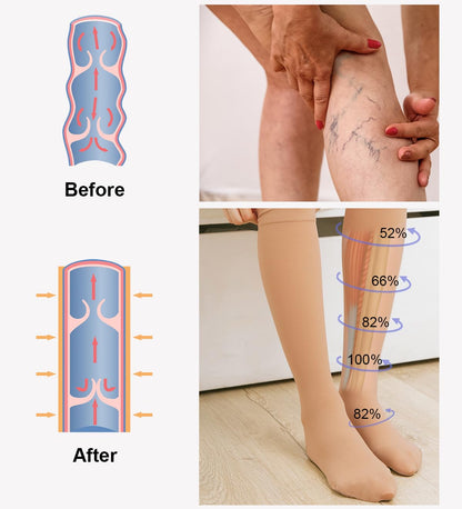 2 Pairs Medical Compression Socks for Women & Men 20-30 mmHg, class 2, Best Graduated Stockings Support Fit for Travel Flight Running Varicose Veins Pregnancy Nurses (2x Beige, XXL)