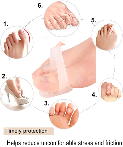 Mcvcoyh Bunion Corrector, Toe Separators with 2 Loops, Big Toe Spacer Suitable for Bunion and Overlap Toe, Infused Aloe Vera Extract