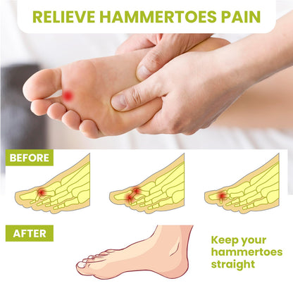 Bukihome Hammertoe Corrector Gel Toe Straighteners - 12 pcs Support Crest for Women & Men - Realign Bent, Crooked, Curled, Claw, Hammer Toes - Clear,Multi-Size