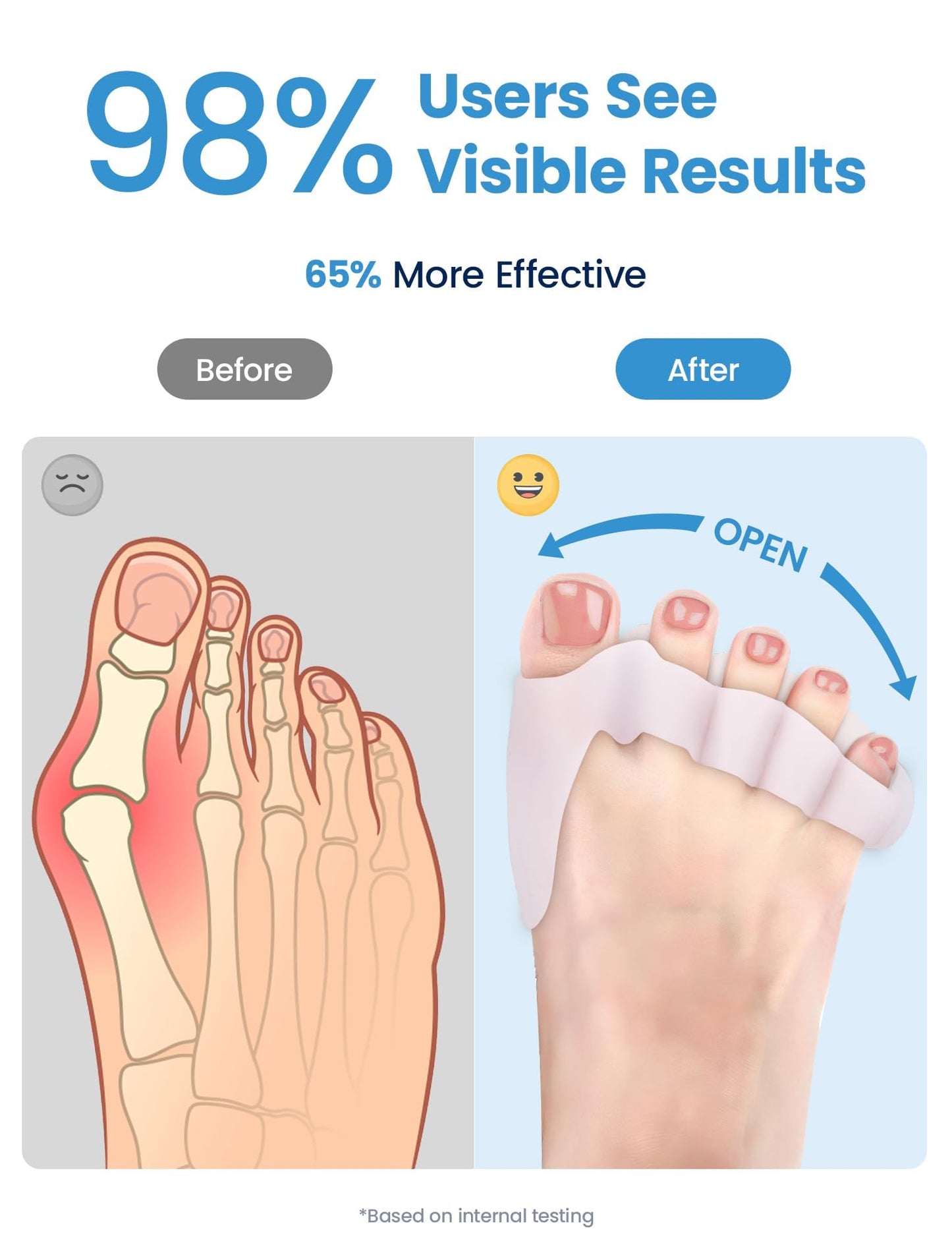 Habioer Toe Separators for Women - Podiatrist Recommended, Toe Spacers for Men, Breathable Bunion Corrector, Plantar Fasciitis(1 Pair)