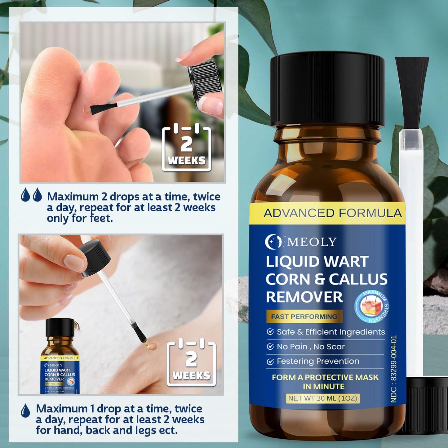MEOLY Fast-Acting Wart Remover Freeze Off : Wart Remover for Men Women - Wart Removal for Plantar Wart, Common Wart, Flat Wart 30 ML