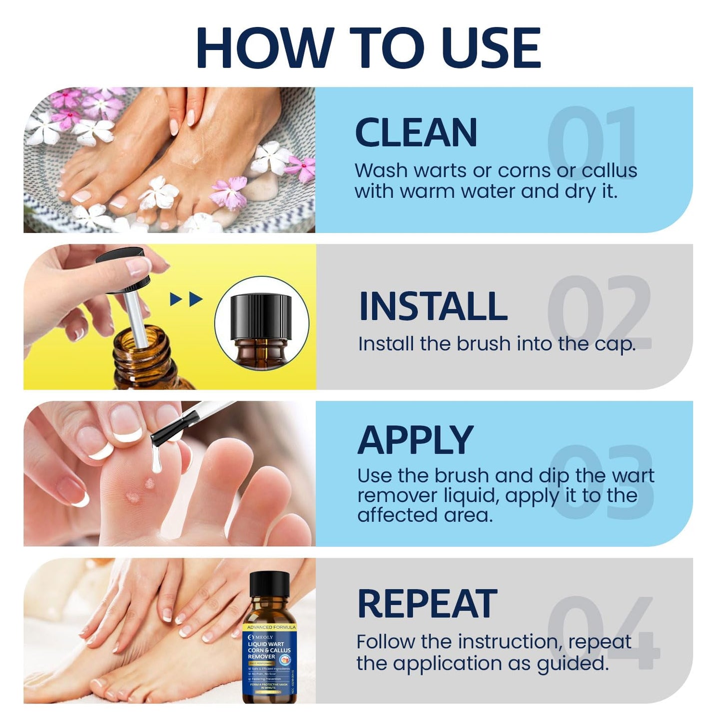 MEOLY Fast-Acting Wart Remover Freeze Off : Wart Remover for Men Women - Wart Removal for Plantar Wart, Common Wart, Flat Wart 30 ML