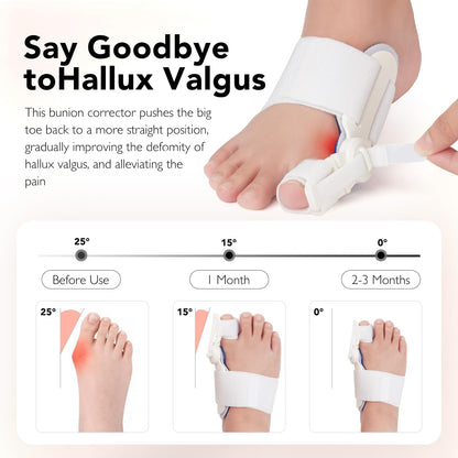 Hayruoy Bunion Corrector for Women & Men, Hallux Valgus Relief and Toe Alignment, include Toe Stretcher Band & Toe Separators, Free Size White