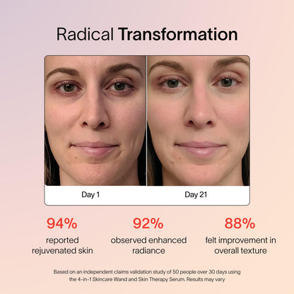 Solawave Skincare Wand & Serum – 4-in-1 Galvanic Current, Face Massager, & Red Light Therapy Wand – 1 Oz Activating Serum for Anti-Aging, Wrinkle Reduction, Face Lift & Hyperpigmentation Skin Care