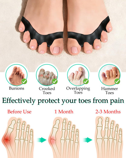 DLMDLM 4PCS Silicone Toe Separators to Correct Toes Alignment for Women and Men, Toe Spacers Straightener for Bunion Relief, Hammertoes and Overlapping Toes (Large)