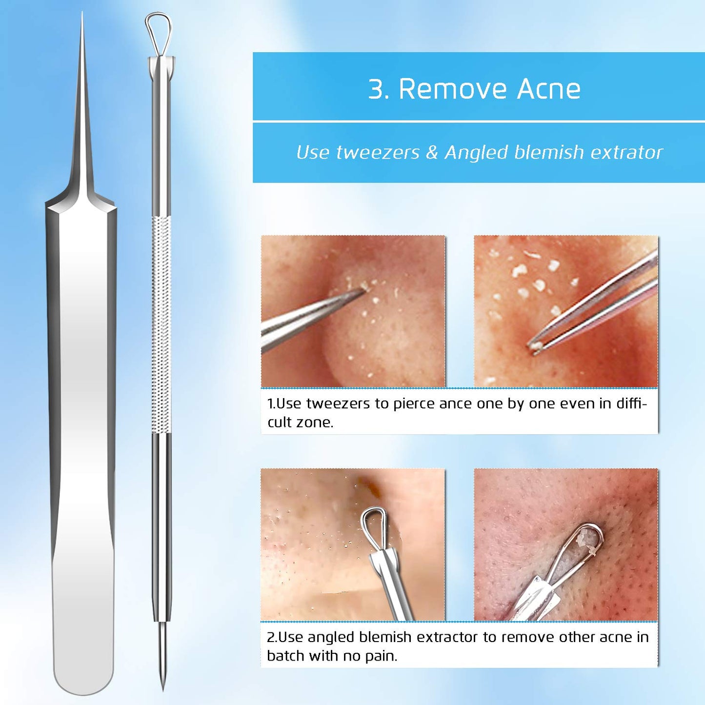 Blackhead Remover Tools Pimple Popper Tool Kit, Comedones Extractor Acne Removal Kit for Blemish, Black Head Remover for face Risk Free Treatment for Whitehead Popping