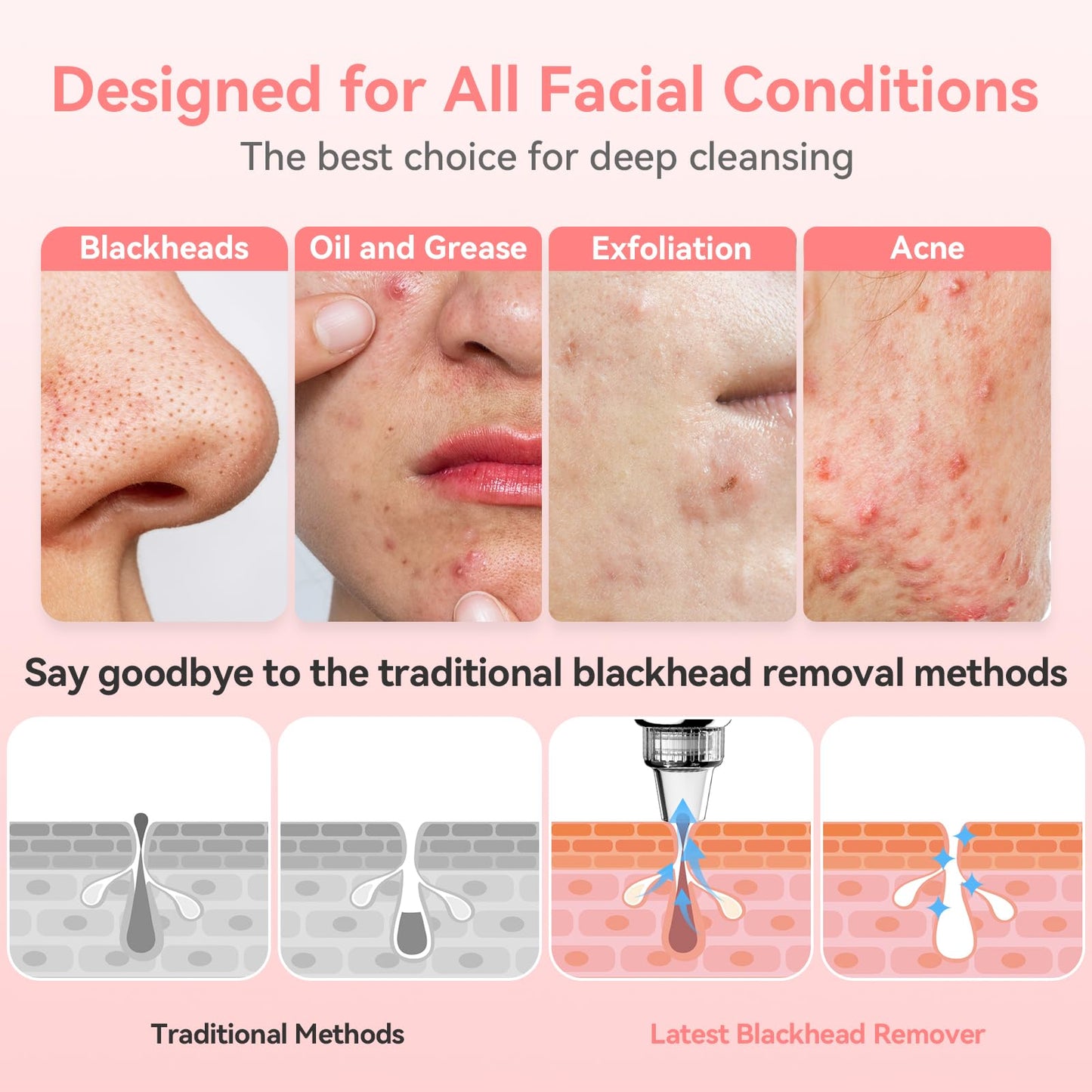 Blackhead Remover Pore Vacuum Upgraded Facial Pore Cleaner Electric Comedone Whitehead Extractor Tool-USB Rechargeable Blackhead Vacuum Kit for Women & Men