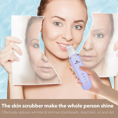 Skin Scrubber Face Skin Spatula Facial Scrubber Spatula for Deep Cleansing Blackhead Remover Pore Cleaner with 4 Modes (White)