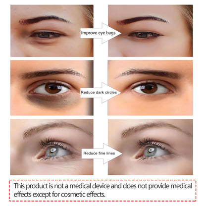 Under Eyes Red Light Therapy Eyelift Massager Glasses,Microcurrent Eye face led red light Beauty Device under Eye Massager Eyes Bag Remover for Reduce Dark Circles Puffiness Wrinkles Relax Eye Strain