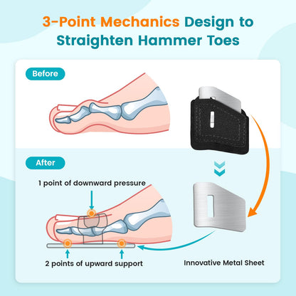 Pozpo Tech Hammer Toe Straightener Corrector Splint Brace for Women fit 2nd 3rd and 4th Toes - (M-Black) - 1 Pair