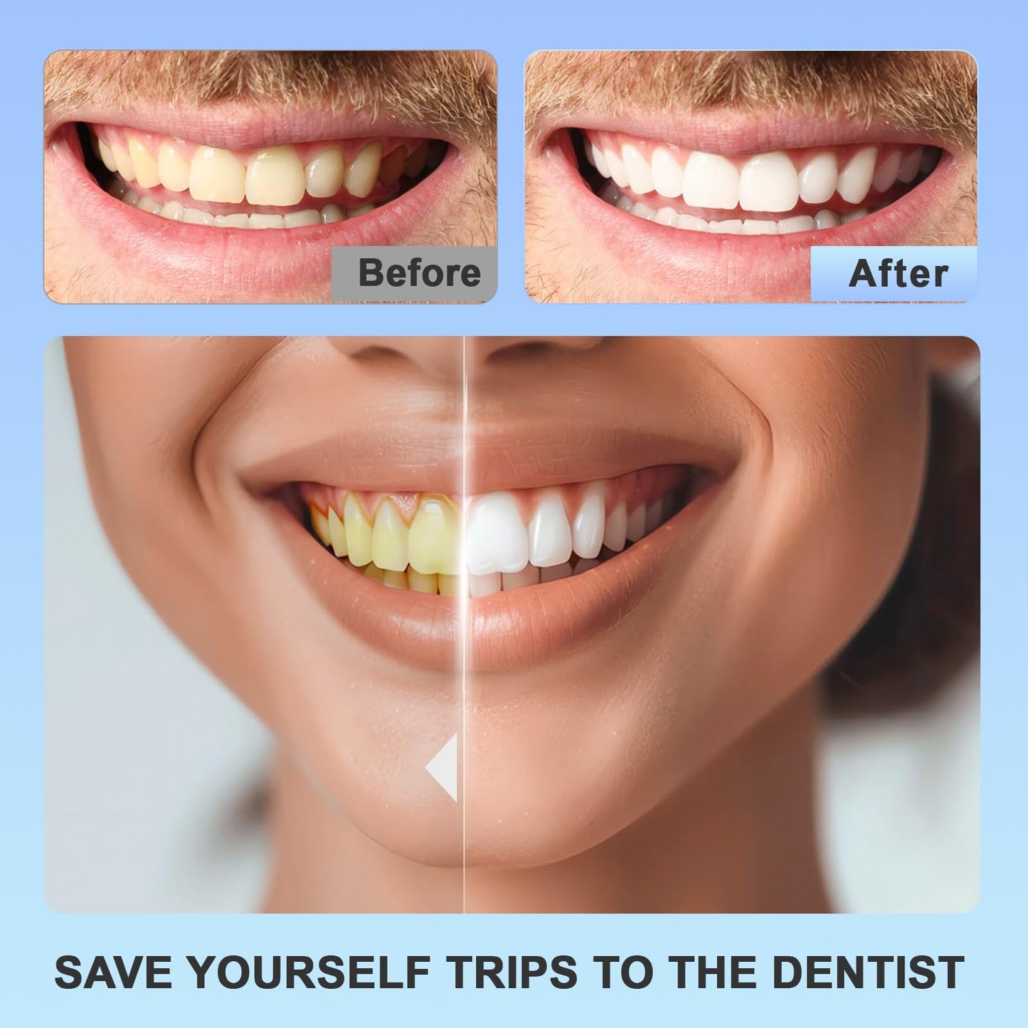 Teeth Whitening Strips 14 Treatments Kit - For Teeth Whitening , Deep Stains Removal, Carefully Designed Whitening Strips, Allowing You To Have a Brighter Smile(28 Pcs)-The Hypothesis of Love 001