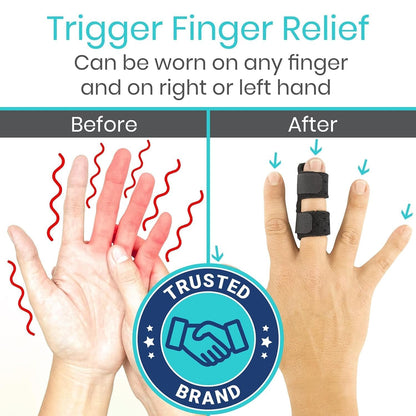 Vive Finger Splint (2 Pack) - Universal Finger Straightener - Broken and Trigger Finger Splints - Brace for Arthritis Pain and Support - Sprain Relief for Middle, Index, Ring, Pinky Fingers (Black)