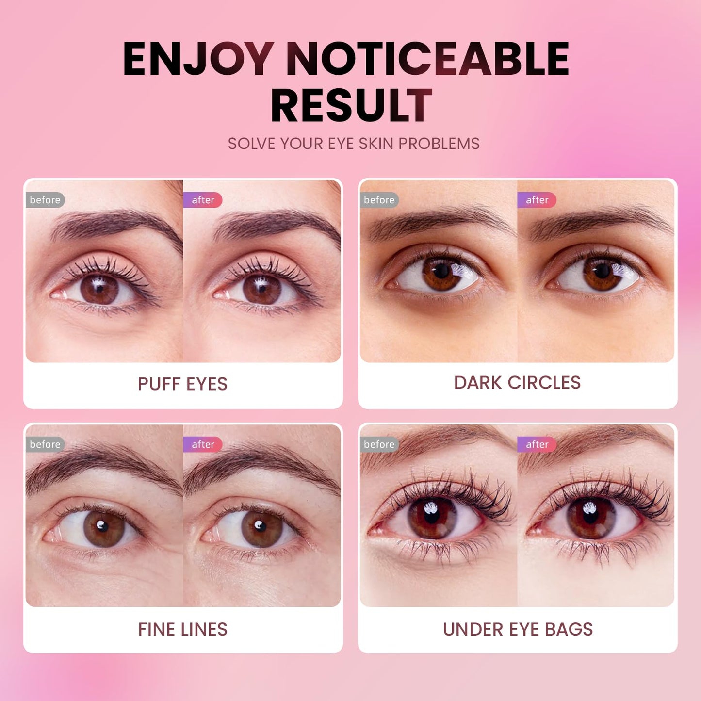 Under Eye Patches (24 Pairs) - New Tri-color Glitter Eye Gel Pads for Dark Circles Puffy Eyes,Under eye Bags,Wrinkles|Natural Collagen Under Eye Mask Patches, Gel Under Eye Patches