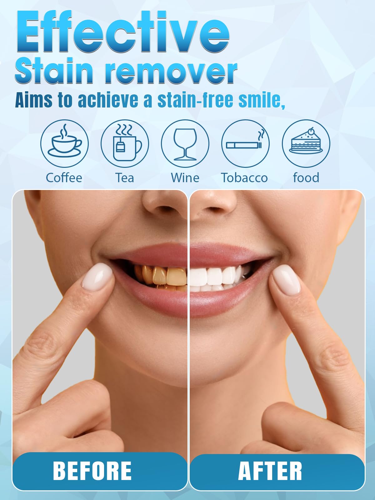 Teeth Whitening Kit with LED Light - White Sensitive Tooth 35% Carbamide Peroxide Gel Pen Dental Mouth Trays Whitener Professional Bright Brace Product System for Home Work Travel