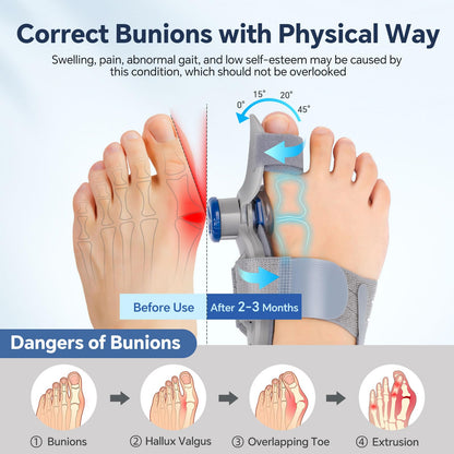 2 Pack Bunion Corrector for Men Women, Toe Splints for Straightening, Adjustable Knob Toe Splint with Silicone Pads, Big Toe Straightener Corrector, Bunion Relief Brace with Dual Toe Straps, Night & Day Use