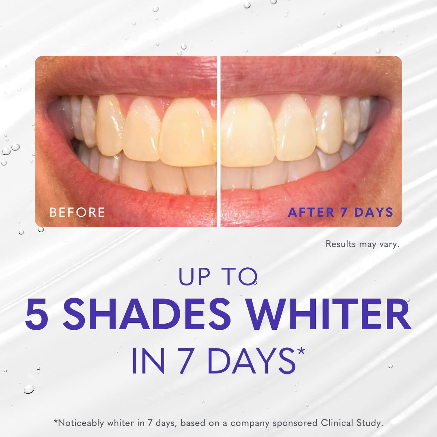 Smileactives Teeth Whitening Gel for Toothpaste with Clinical-Grade Hydrogen Peroxide, Tooth Stain Remover for White Teeth, Dentist Quality Pro Whitening Gel to Remove Coffee Stains, 2 oz Bottle