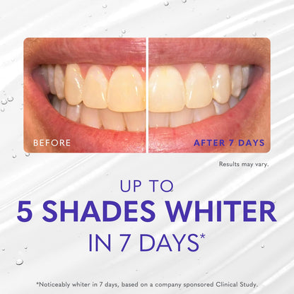 Smileactives Teeth Whitening Gel for Toothpaste with Clinical-Grade Hydrogen Peroxide, Tooth Stain Remover for White Teeth, Dentist Quality Pro Whitening Gel to Remove Coffee Stains, 2 oz Bottle