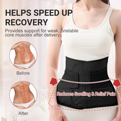 Trendyline Postpartum Belly Band Wrap: Abdominal Binder Post Surgery Postpartum Belly Wrap Post Partum Binder - C Section Recovery Support Belt Post Partum Girdle Stomach Hysterectomy Belly Band