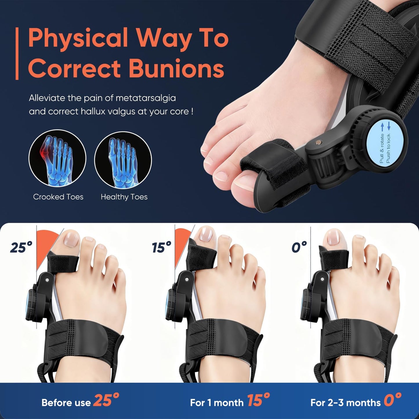 AKFDD Bunion Corrector for Women & Men, Adjustable Knob Dual-Action Bunion Splint with Silicone Pad - Orthopedic Toe Straightener & Separator for Hallux Valgus Relief, Fits Left/Right Feet (Black)