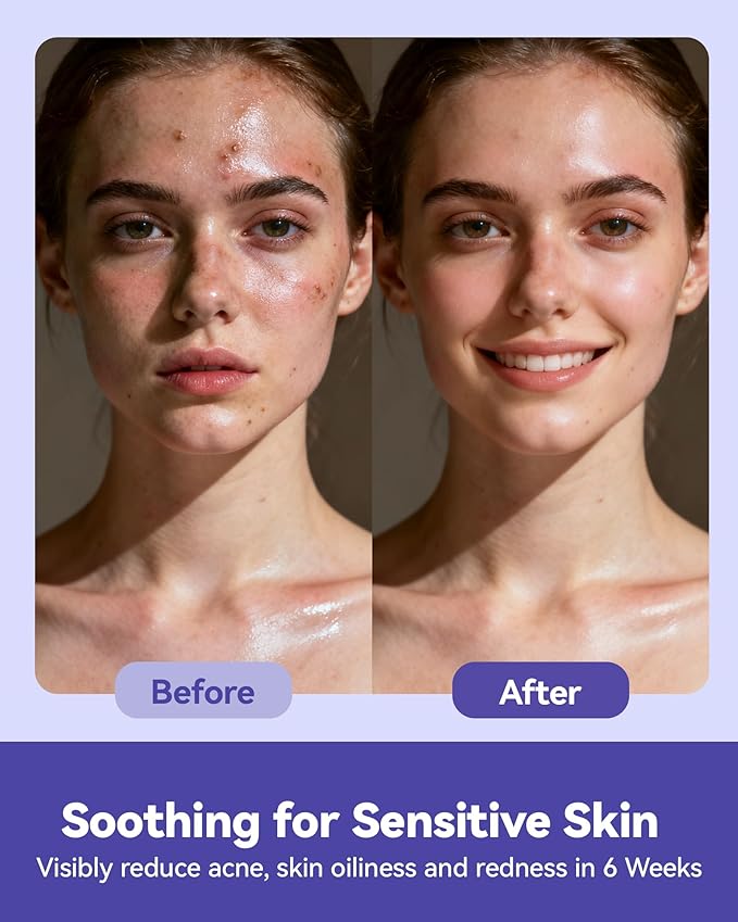 Face Towels Disposable, Face Towelette Disposable, Soft Disposable Face Towel