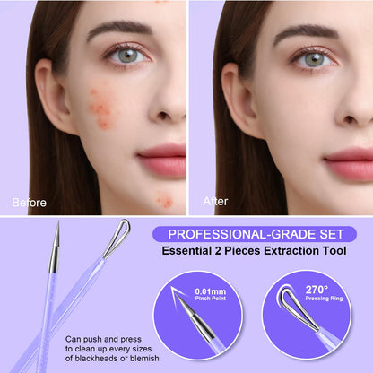Teenitor Pimple Extractor Acne Treatment Tool Surgical Grade Blackhead Comedone Removal 2-in-1 Popper Tool for Face Nose Blackhead Extractor Tool Silver