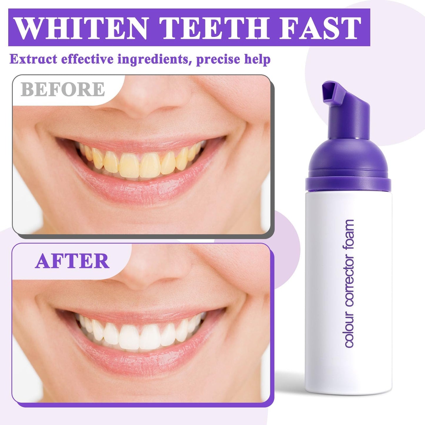 Purple Toothpaste for Teeth Whitening,Purple Teeth Whitening Kit,Tooth Stain Removal Colour Corrector
