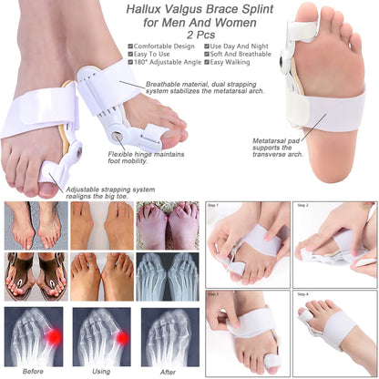 GELMAY 15Pcs Bunion Corrector, Hallux Valgus Relief Pads Toe Spacer Straightener Big Toe Separator Correction Splint Hammer Gel Metatarsal Sleeve Protector Brace Exercise Strap