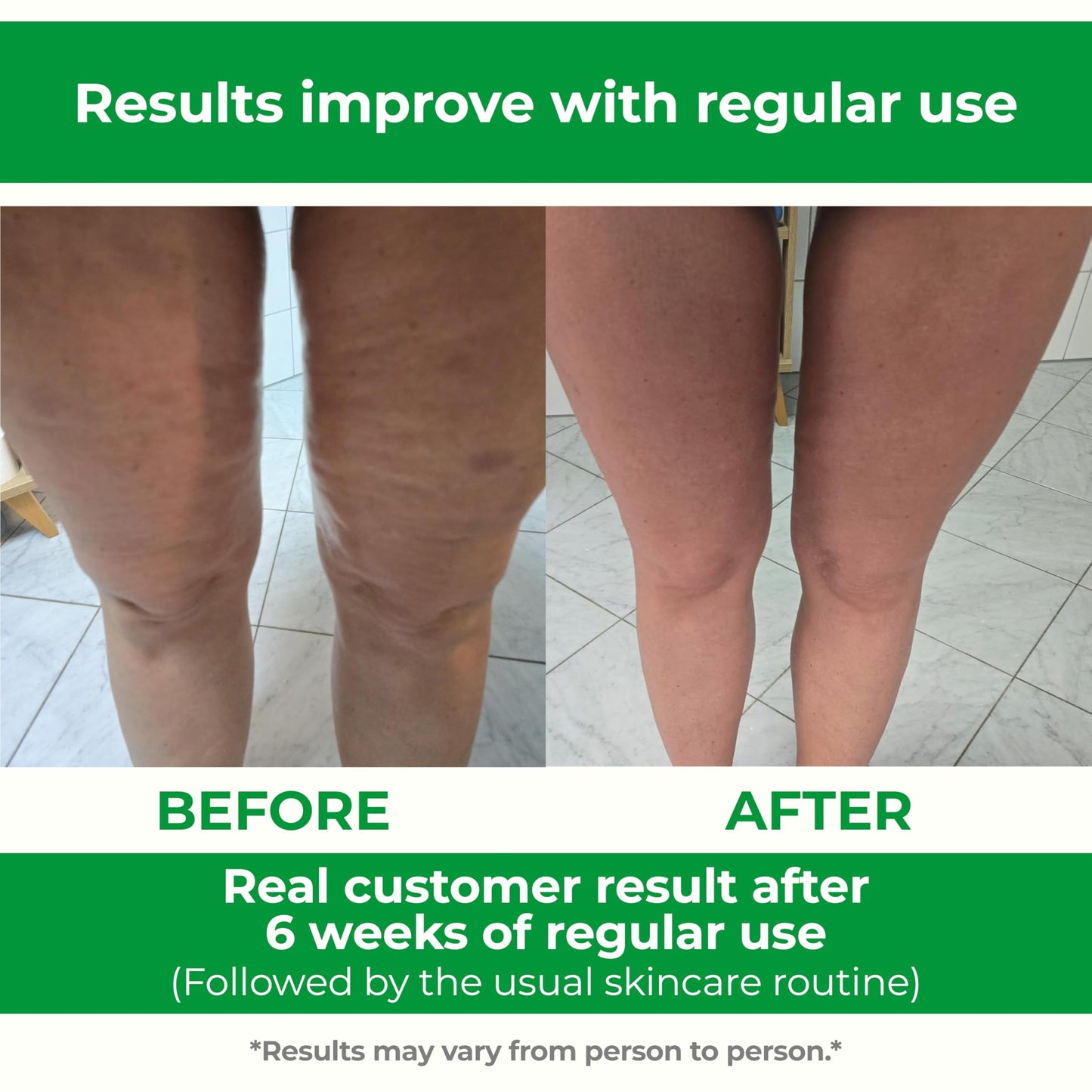 TESMED Cellulite