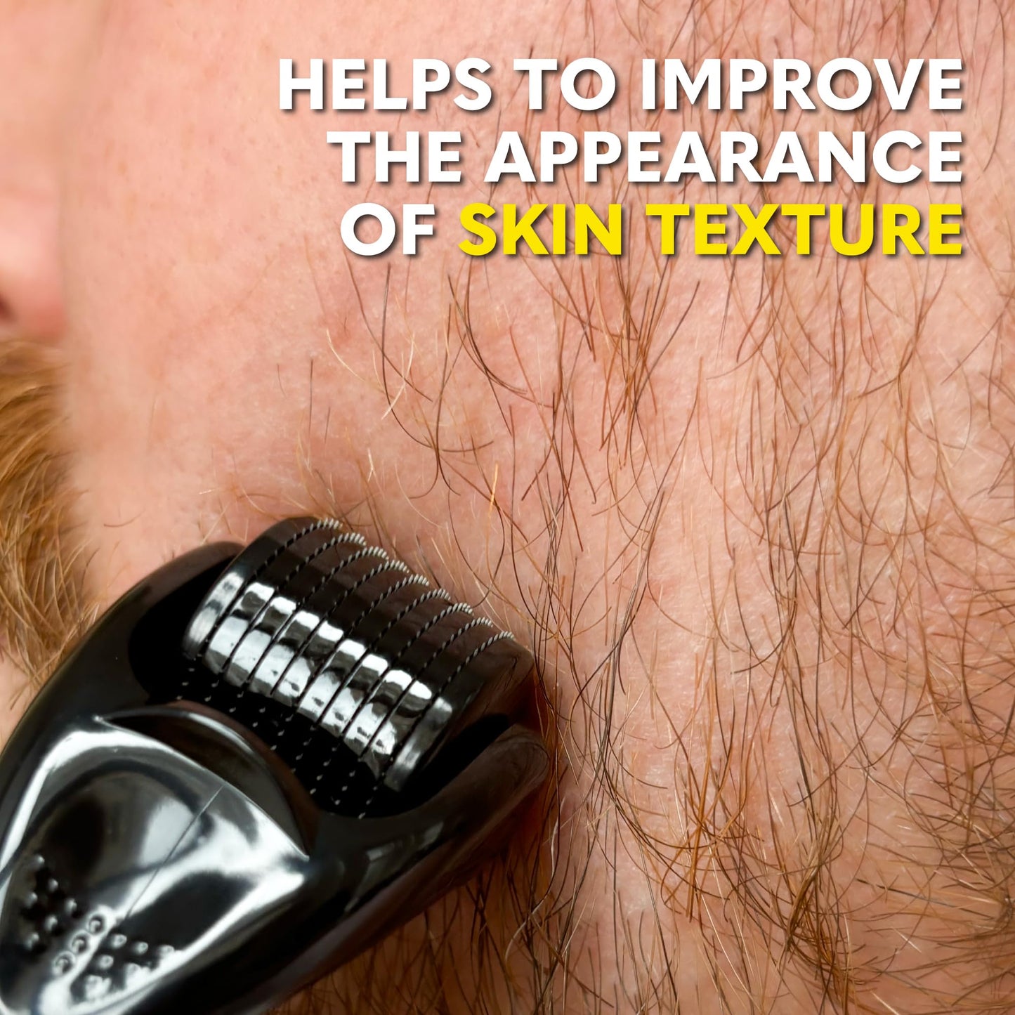 The Beard Club Derma Roller for Face, Body and Scalp - Microneedling for Men and Women with 540 Titanium Microneedles - Beard Roller & Micro Needling Scalp Hair - Black