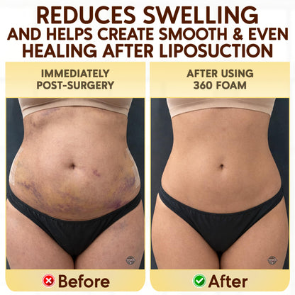 Talk the Toks Post Surgery 360 Lipo Foam Wrap Around | Tummy Tuck Binder Post Surgery | Soft & Breathable Material, 360 Wrap around Liposuction | BBL Post Surgery Supplies (Small)