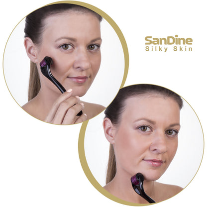 Microneedle Derma Roller - 540 Micro Needle Skin Care System - Ideal to Keep Your Skin Young and Radiant - Titanium for Silky Smooth and Beautiful Skin - Includes FREE E-Book -By Sandine (0.3mm)