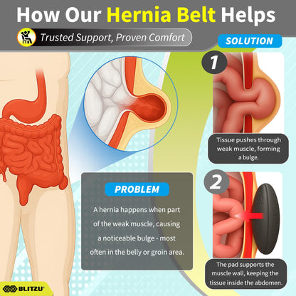 BLITZU Umbilical Hernia Belt for Men & Women, Abdominal Binder Adjustable Truss Support with 2 Compression Pads for Naval, Ventral, Incisional, Epigastric, Belly Button Hernias, Pre Post Surgery L-XL